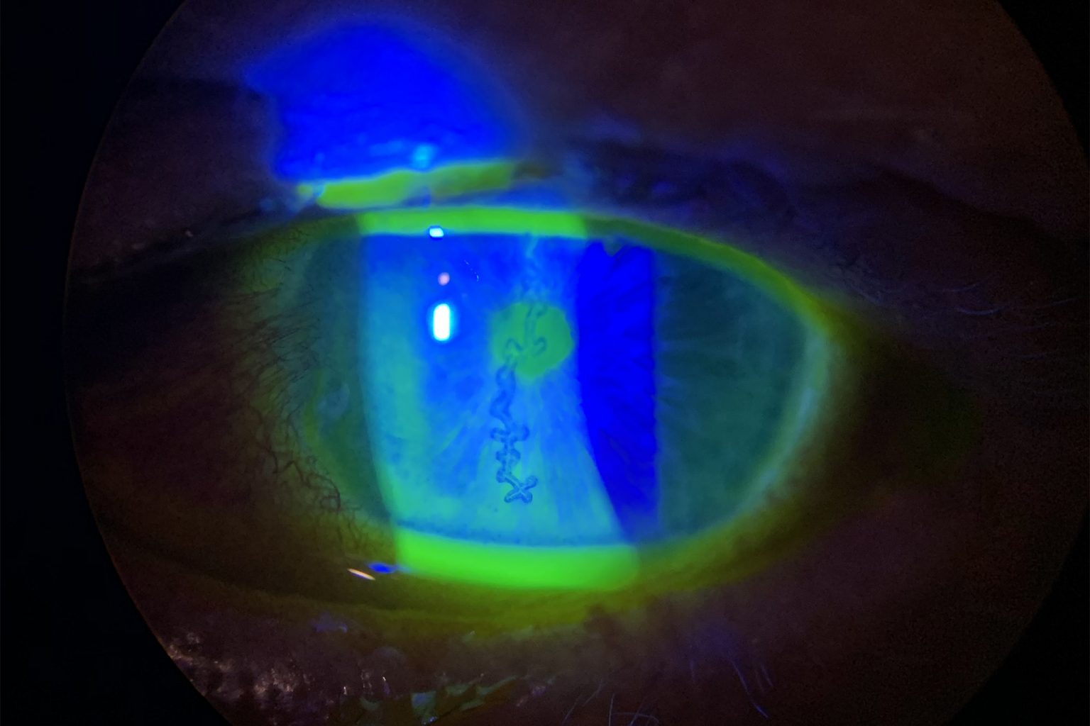 FAQs Tarboro Eye Associates